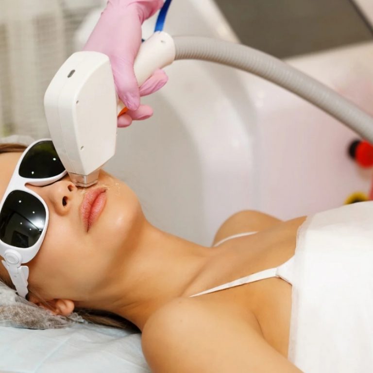 Face Laser Hair Removal North Shore